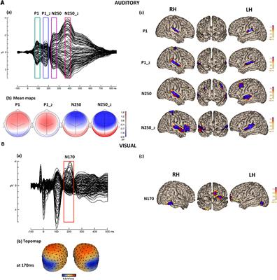 Brain Source Correlates of Speech Perception and Reading Processes in Children With and Without Reading Difficulties